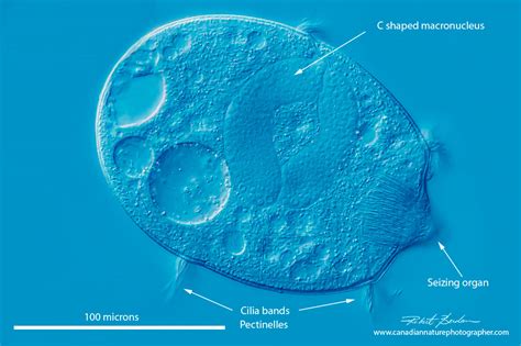  Didinium: Un Prédateur Microscopique aux Cils Vibrants!