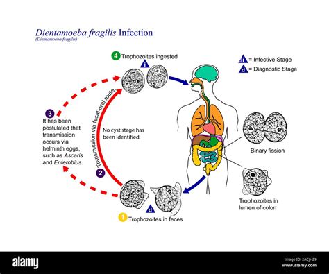  Dientamoeba! Un parasite intestinal fascinant au cycle de vie complexe